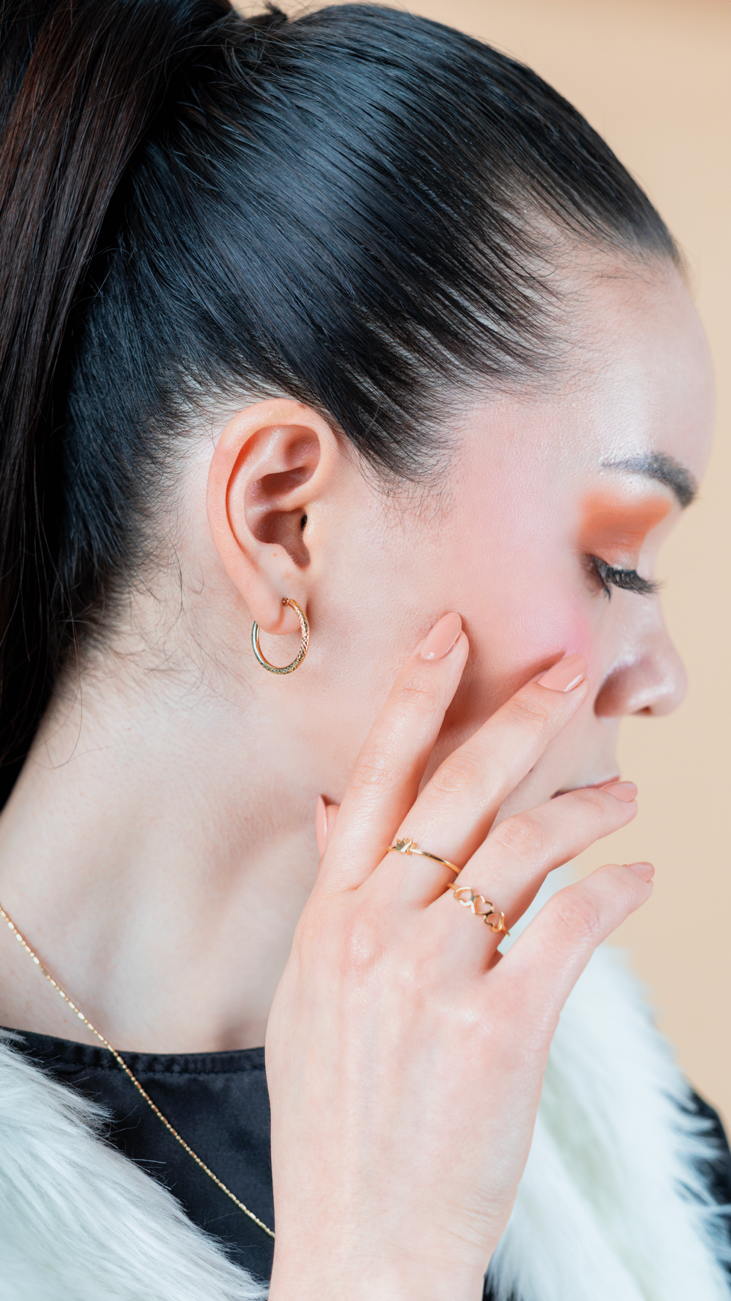 Aretes